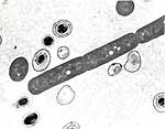 Обычная и споровая форма бактерий сибирской язвы